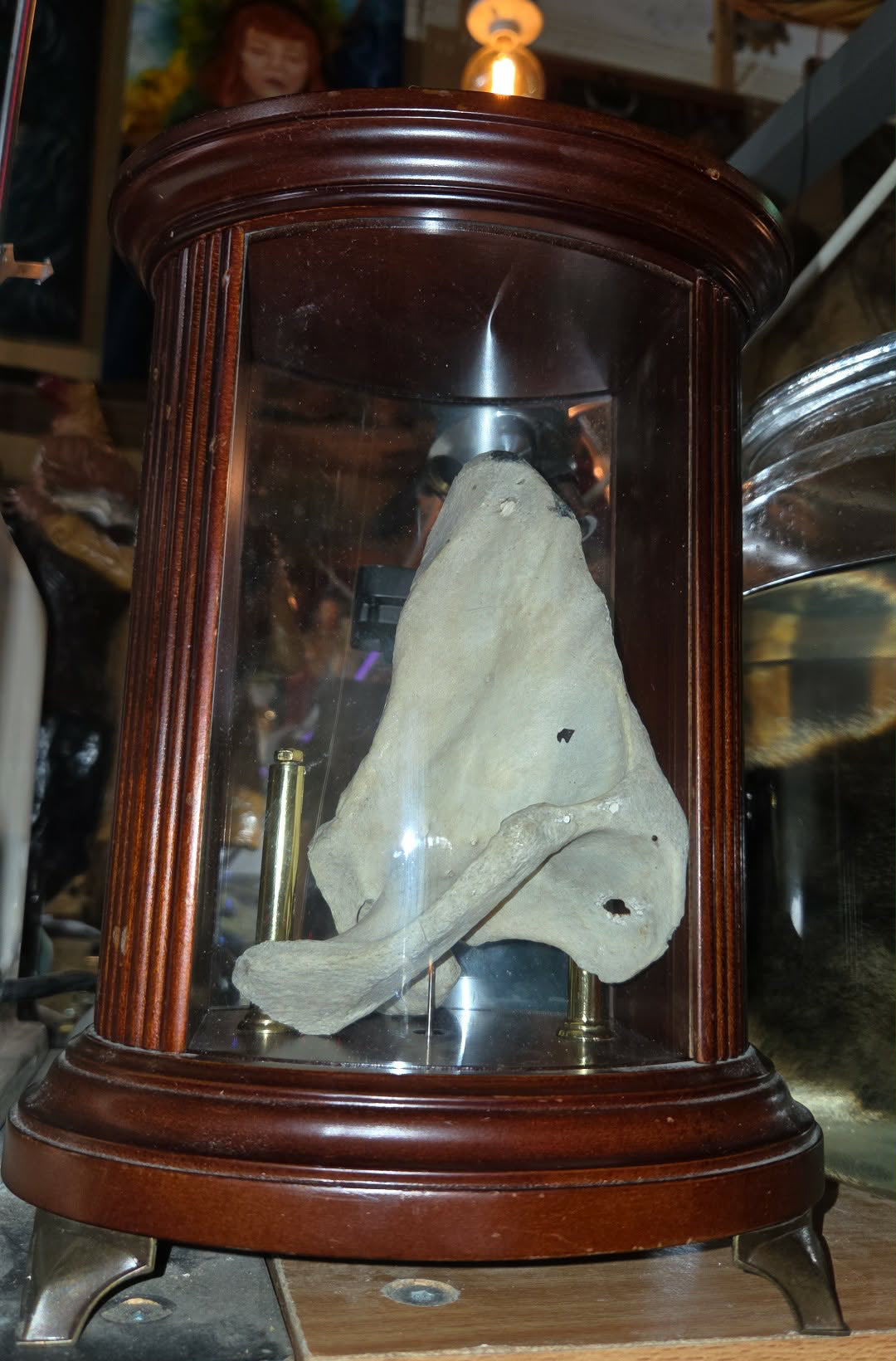 Omoplate médicale