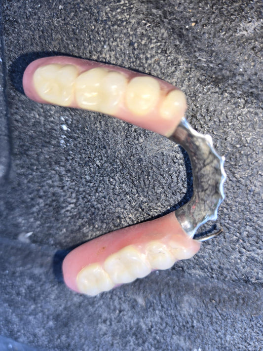 Prothèse dentaire usagée.