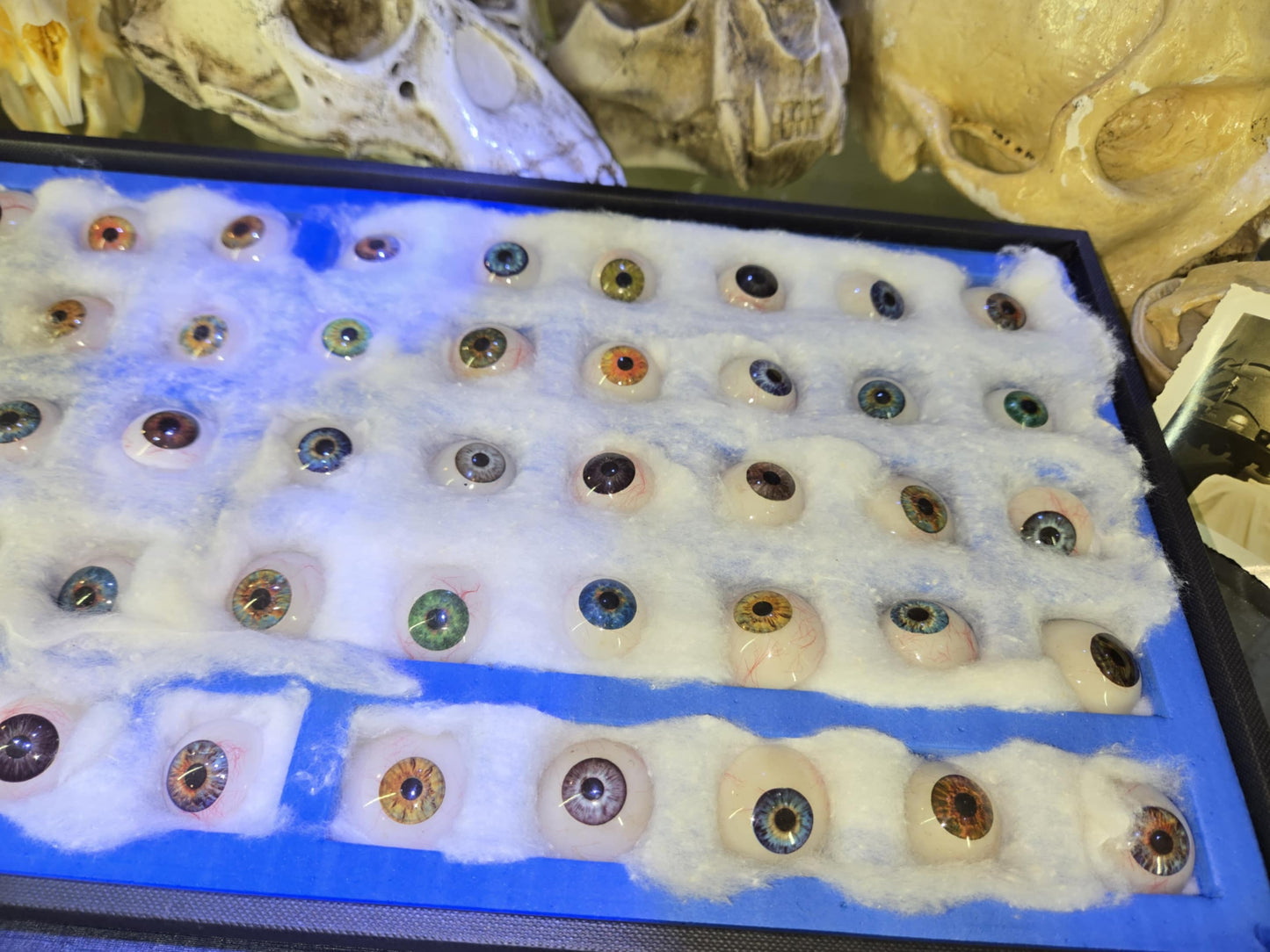 Collection complète de prothèses oculaires antiques