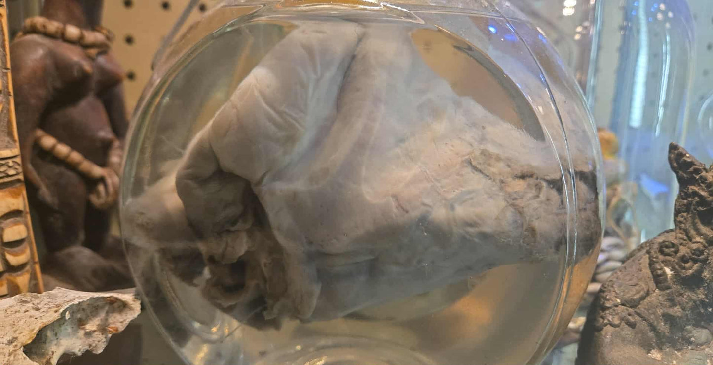 Coeur d'autruche dans le formol