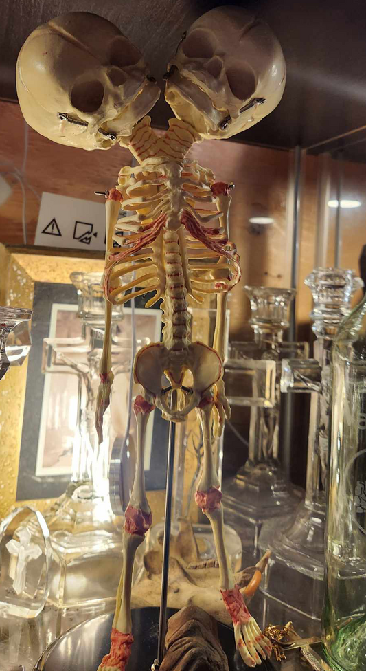 Squelette médical bébé à deux têtes repro