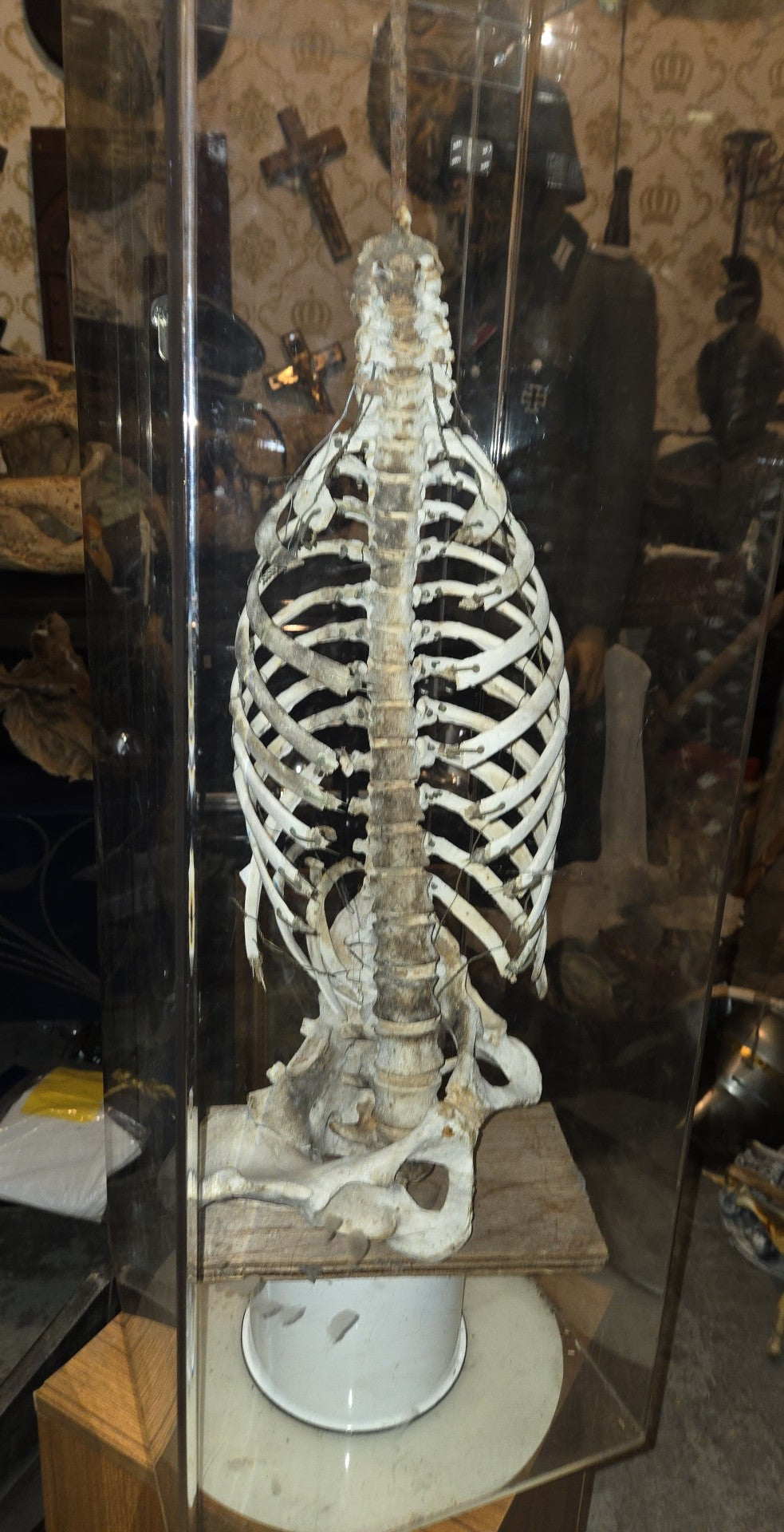 Médical colonne vertébrale, cage thoracique et bassin humain.