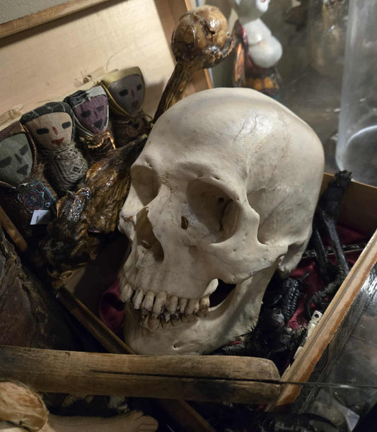 Crâne humain antique médical