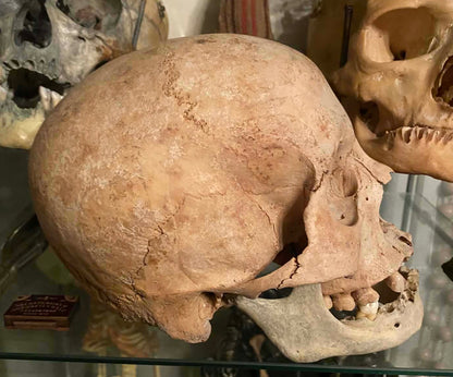 Crâne antique homo sapiens médical