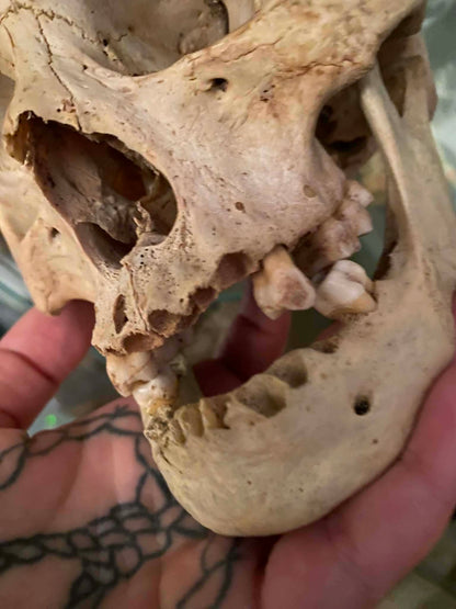 Crâne antique homo sapiens médical