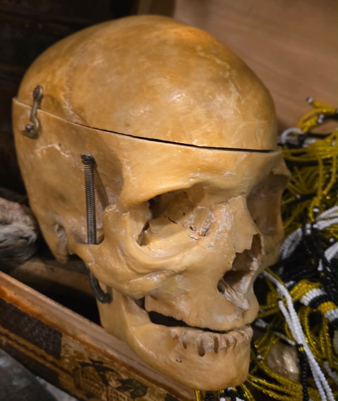 Véritable crâne d'Homo Sapiens sapiens sans dent