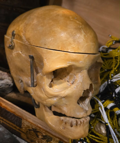 Véritable crâne d'Homo Sapiens sapiens sans dent