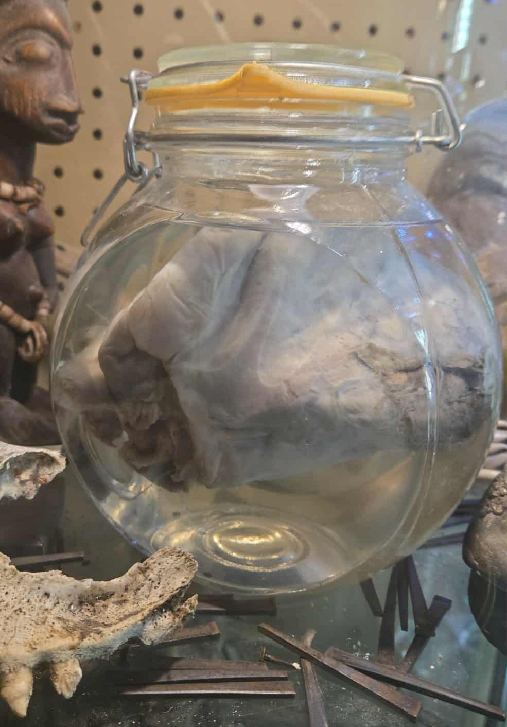 Coeur d'autruche dans le formol