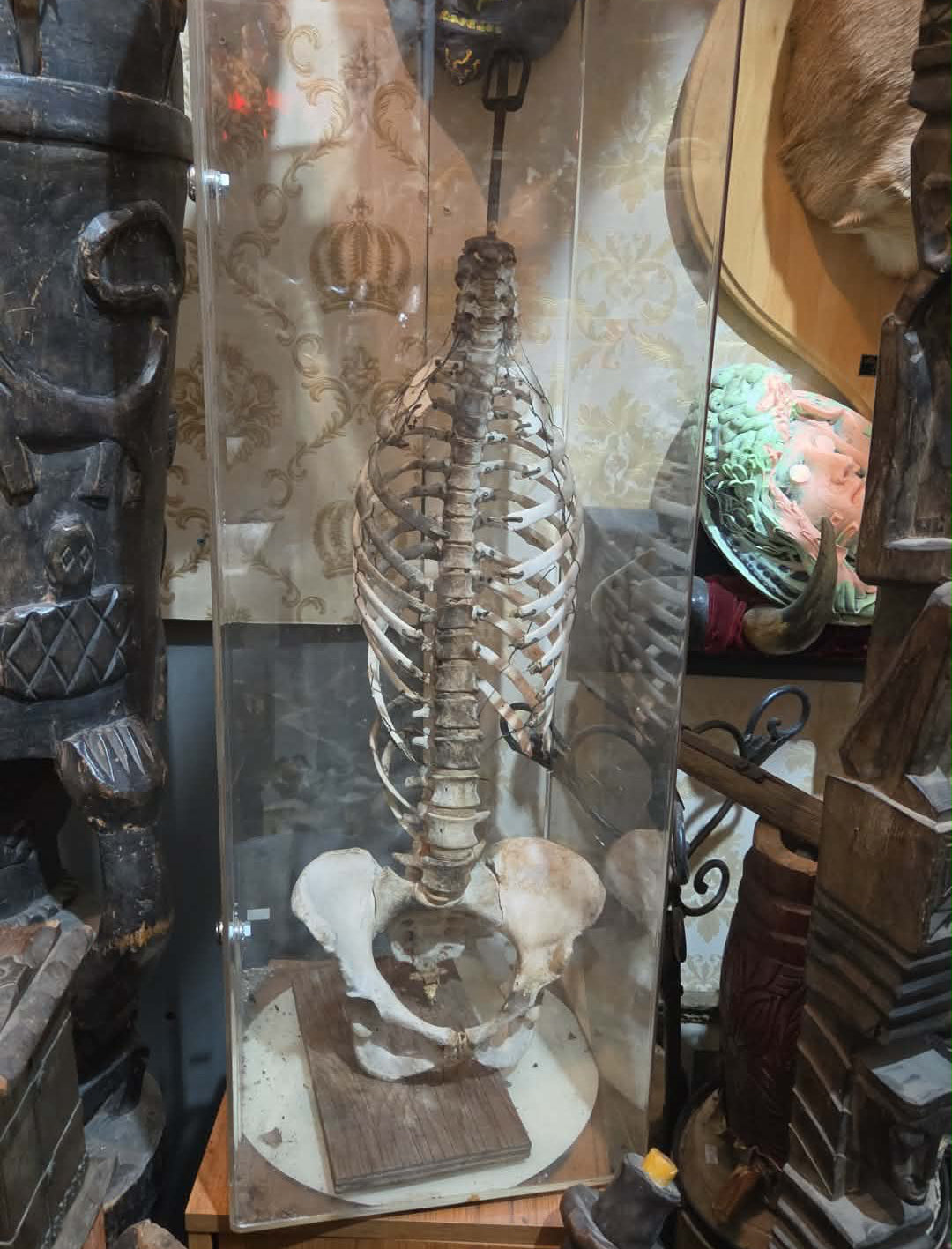 Matériel pédagogique médical vintage