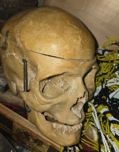 Véritable crâne d'Homo Sapiens sapiens sans dent